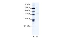 ZNF134 Rabbit anti-Human, Polyclonal, Novus Biologicals 0.1 mL | Buy Online | Novus Biologicals | Fisher Scientific